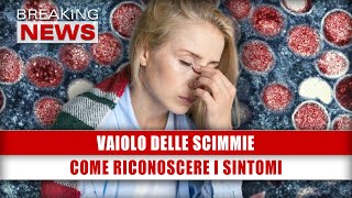 Vaiolo Delle Scimmie Come Riconoscere I Sintomi [upl. by Aicinat]