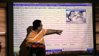 An EEG introduction [upl. by Wendt712]