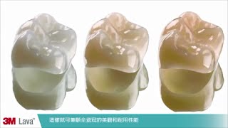 3M™ Lava™ 全瓷假牙 – 符合全球患者對全瓷牙的期待 [upl. by Chak]