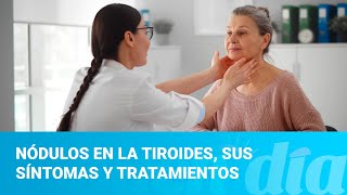 Nódulos en la tiroides sus síntomas y tratamientos [upl. by Glenden]