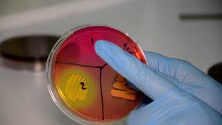 The Staphylococci and The Streptococci Microbiology Laboratory Practical Part [upl. by Quinton]