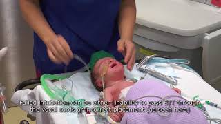 Paediatric Anaesthetics Chapter 3  Failed intubation neonate [upl. by Suh829]