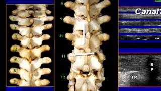 Regional Anesthesia  Sonoanatomy II Truncal Spine and Paravertebral Regions [upl. by Nej]