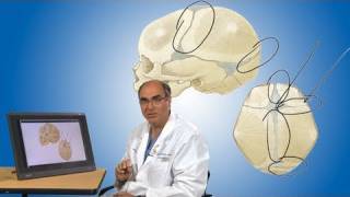 Plagiocephaly and its treatment  Boston Children’s Hospital [upl. by Rim]