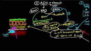 Pathophysiology of Cirrhosis [upl. by Semmes]