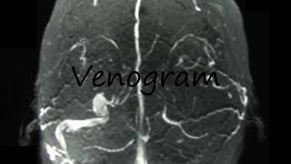 How to Pronounce Venogram [upl. by Hulen60]