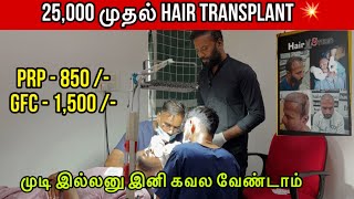 25000 முதல் Hair transplant 💥 Chennai Hair Studio Trichy  Affordable Hair Transplant In the world [upl. by Zach392]