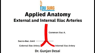 Anatomy essentials  Internal iliac artery branches External iliac artery May Thurner Syndrome [upl. by Behlke]