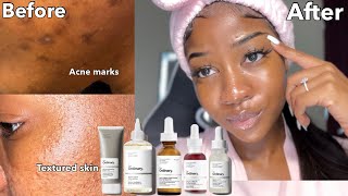 PRODUCTS THAT REMOVE DARK MARKS amp TEXTURED SKIN FAST  The ordinary [upl. by Jarrett135]