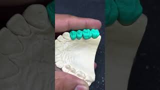 Mastering Tooth Carving The Art of Making a Perfect Dental Crown shorts viral trending bds [upl. by Anivram]