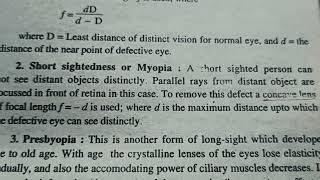 Defect of vision hypermetropia myopia presbyopia and astigmatism [upl. by Eahsram]