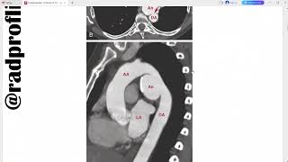 FUNDAMENTALS OF BODY CT [upl. by Jon]