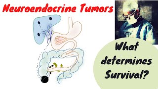 Neuroendocrine Tumors What determines outcome [upl. by Innavoig827]