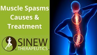 Muscle Spasms Causes and Treatment [upl. by Egrog91]