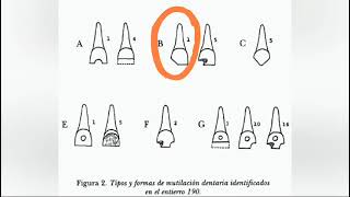 Mutilaciones e incrustaciones dentarias en Teotihuacan [upl. by Badr]