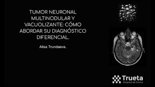 692 Tumor neuronal multinodular y vacuolizante como abordar su diagnóstico diferencial [upl. by Ogg]