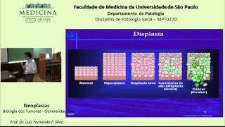 Neoplasia Biologia dos Tumores [upl. by Anilosi]