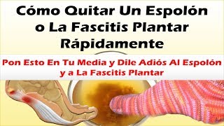 Pon Esto En Tu Media y Dile Adiós Al Espolon y a La Fascitis Plantar Como Quitar Un Espolon Rapido [upl. by Lletniuq122]