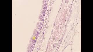 Pseudostratified columnar epithelium with cilia Trachea [upl. by Orvan]