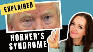 Horners Syndrome Explained Whiteboard Tutorial with Donald Trump [upl. by Akcemat]