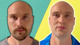 BEST Facial Hair Style For The BALD MAN [upl. by Toy]