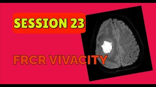 FRCR VIVACITY SESSION 23 [upl. by Nosna]