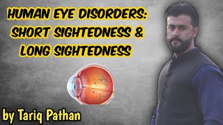 Human Eye Disorders Short Sightedness amp Long Sightedness  Tariq Pathan [upl. by Lenoj751]