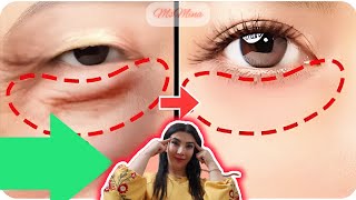 8mins Eye Bags Removal Exercise amp Massage You Must Do 💥 eyewrinkles faceyoga [upl. by Tamarah]