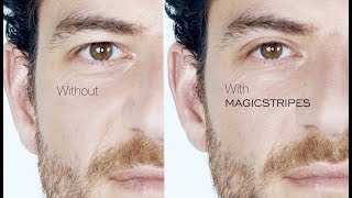 WWWMAGICSTRIPESCOM  Immediate Eyelid Lifting Without Surgery [upl. by Dranoc326]