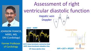 Assessment of right ventricular diastolic function [upl. by Maribelle]