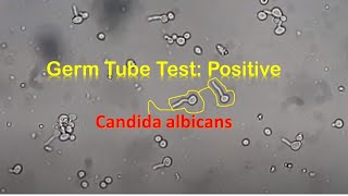 Germ Tube Test Positive Candida [upl. by Anam]