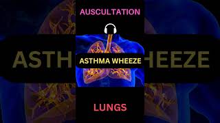 Asthma Wheeze Sounds  Asthma Whistling Sounds shorts medicine medstudent usmle plab asthma [upl. by Terza]