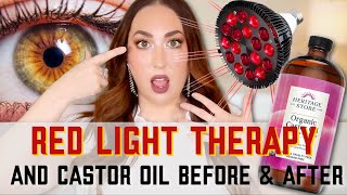 3 POWERFUL Castor Oil Benefits for THE FACE  WITH RED LIGHT THERAPY [upl. by Lednik398]