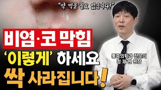 약 없이 알레르기 비염 코 막힘 치료하는 방법 싹 사라집니다  코호흡 코순환 증가시키는법 [upl. by Origra]