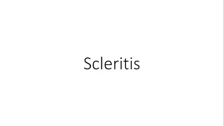 Scleritis  Ophthalmology [upl. by Baird823]