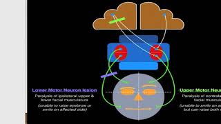 broca s area  broca s aphasia  motor aphasia [upl. by Rufina]