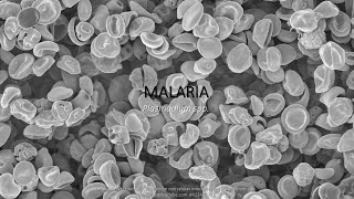 Malaria SINTOMATOLOGÍA notas de estudio [upl. by Paxon875]