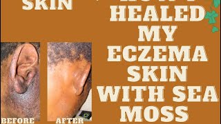 Chondrus Crispus irish moss sea moss For Eczema Skin seamoss irishmoss antiinflammatory [upl. by Des]