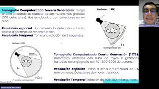 Tomografía Computarizada [upl. by Anelhtak]