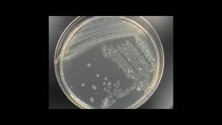 Identification of Unknown Bacteria [upl. by Collier214]