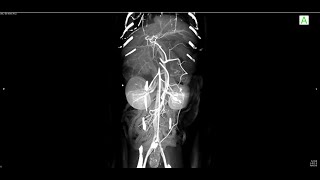 Feline Hepatic amp Pancreatic Masses by Vimago HDVI CT [upl. by Abixah]