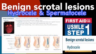 Benign scrotal lesions Hydrocele amp Spermatocele in HindiUrdu by first aid for USMLE step 1 [upl. by Mayeda]