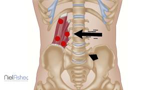 Quadratus Lumborum  Trigger Point Anatomy [upl. by Amery]