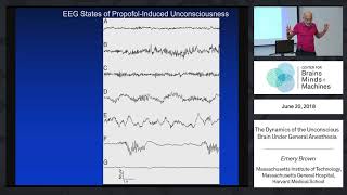 The Dynamics of the Unconscious Brain Under General Anesthesia [upl. by Pell420]