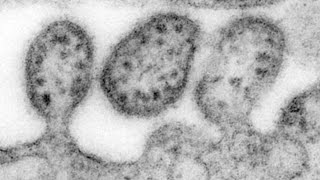 Your questions about Lassa fever answered [upl. by Gavrila273]