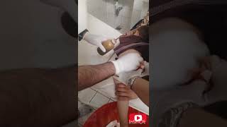 Gluteal abscess Drainage 😱🫣😳🙄تخلیه آبسی گلوتیلviral subscribe explore india follow tiktok [upl. by Anstice]