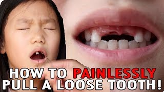 How To Pull A Loose Tooth  No Cry Teeth Pulling Method  Easily Extract Baby Teeth [upl. by Chesna]