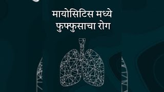 मायोसिटीस मध्ये फुफ्फुसचा रोग Pulmonary disease in myosistis [upl. by Nowd]