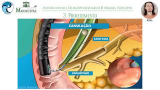 AMC 12021  10  ANATOMIA APLICADA À COLANGIOPANCREATOGRAFIA RETRÓGRADA ENDOSCÓPICA CPRE [upl. by Nyledaj]