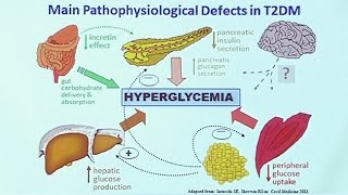 Making Sense of Diabetic Medications [upl. by Leonteen]